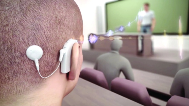 江西將電子耳蝸植入術(shù)等192個項目納入醫(yī)保