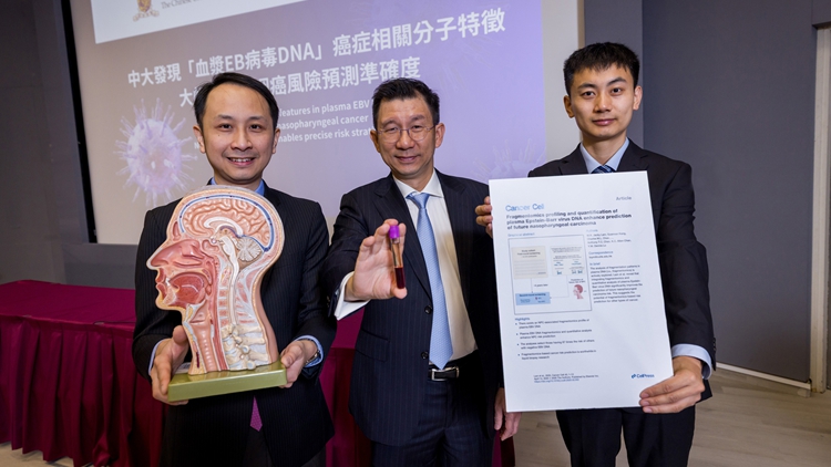 中大成功識(shí)別血漿EB病毒DNA 大幅提升鼻咽癌風(fēng)險(xiǎn)預(yù)測(cè)準(zhǔn)確度